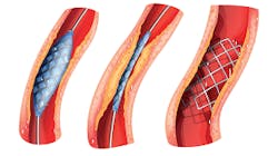 0318-ATE-Figure-1-Small 0318-ATE-Figure-1-Small