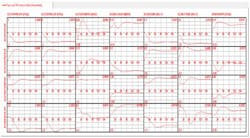 CG1401-MVC2 CG1401-MVC2