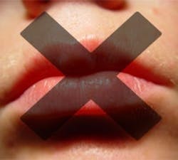 1660604670200 Cg1106 Mouth 1660604670200 Cg1106 Mouth