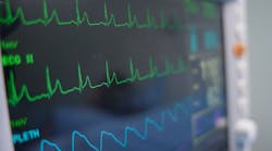 66759ed253a6a831f8eac00b Deadtime Compensation Opportunities And Realities 66759ed253a6a831f8eac00b Deadtime Compensation Opportunities And Realities